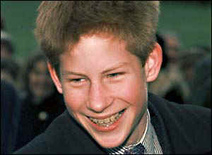 Prince Harry with braces