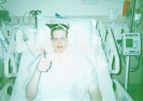 I was swollen like a bowling ball immediately after surgery: