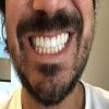 teeth whitening
