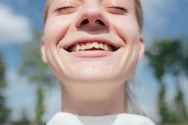 Crooked Teeth