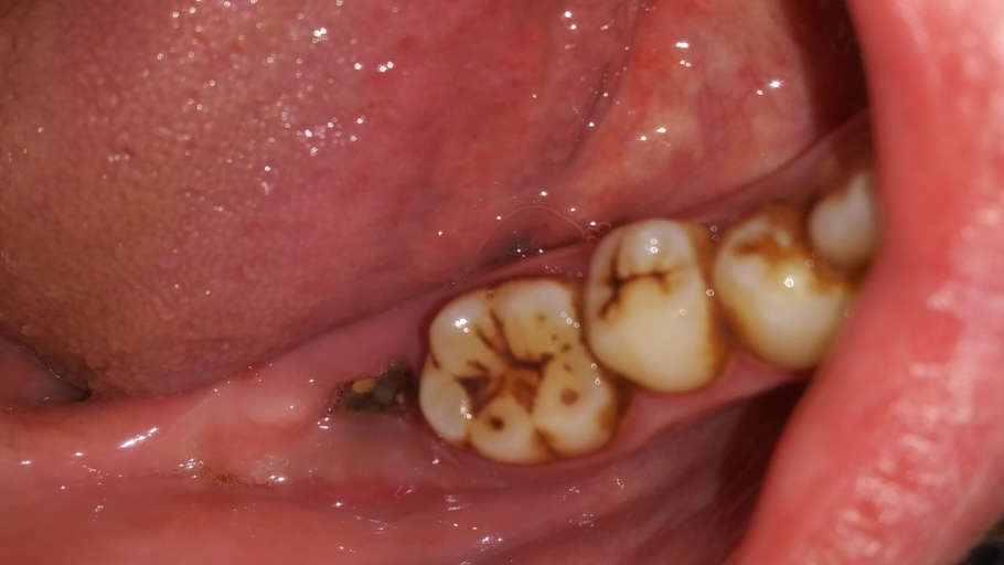 Does This Look Normal