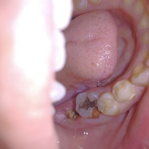 My Image 3