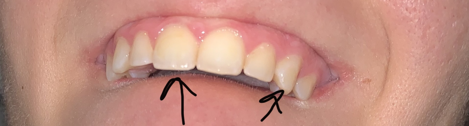 Weird Receding Gum Type Thing?